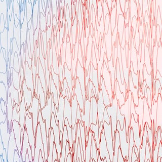focal-resection-1290x1290